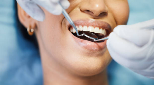 Best Emergency Care for Gum Disease in Tuolumne City, CA